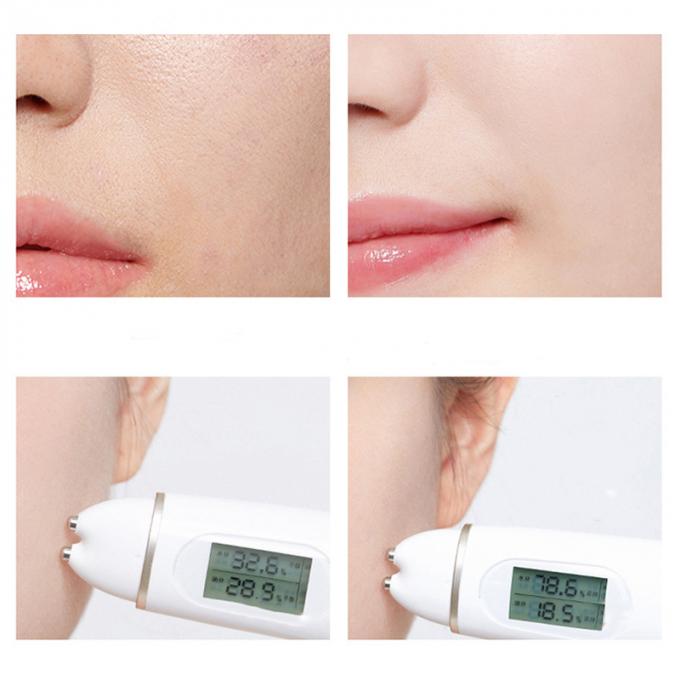 soro da acne da essência do bioaqua